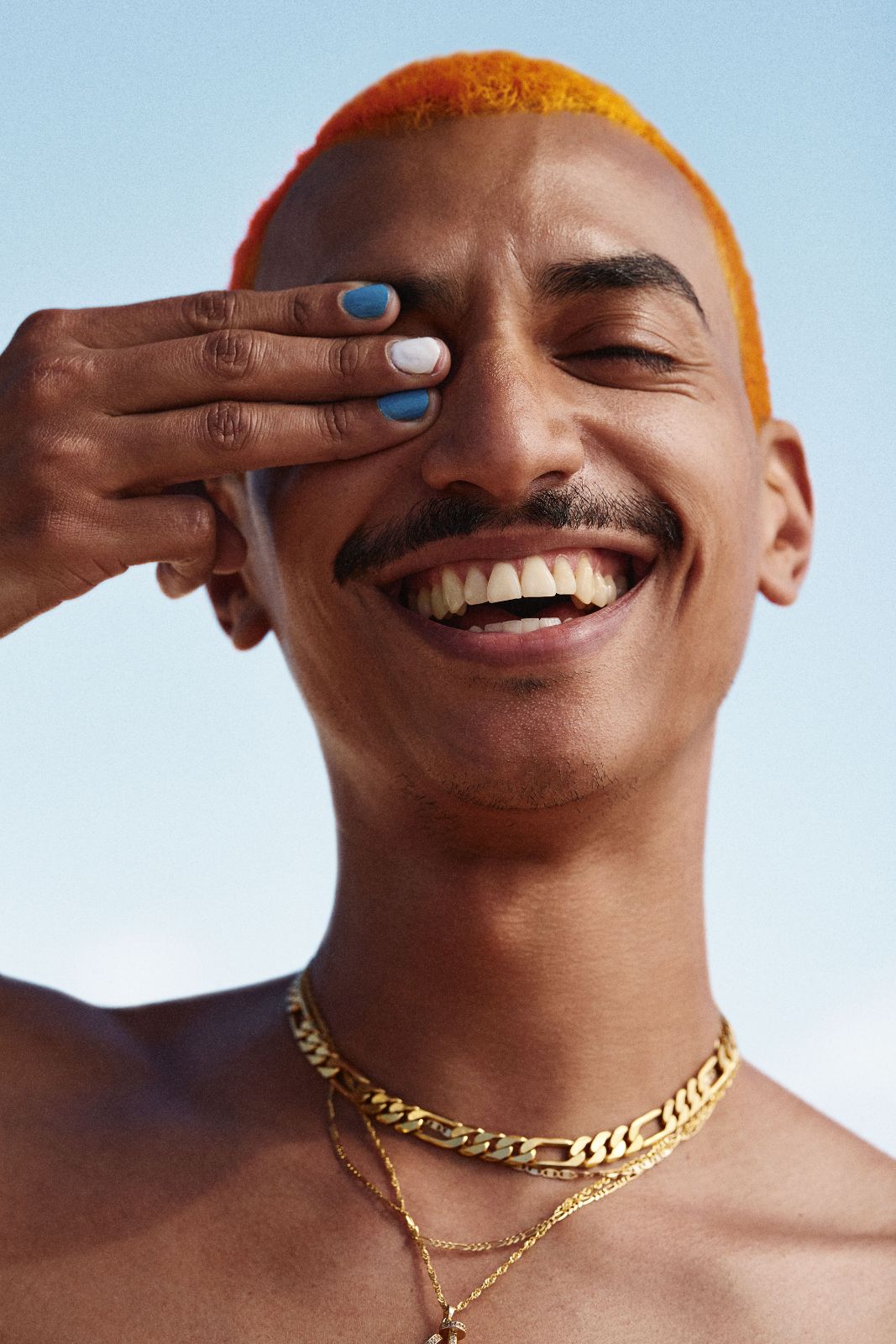 Orange haired man playfully covering one eye with beautifully manicured hand